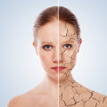 Understanding Autoimmune Diseases and Skin Ageing