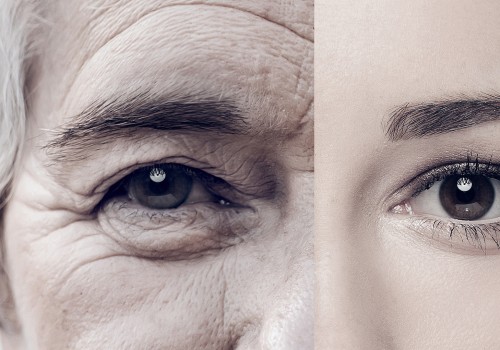 Genetic Predisposition to Skin Ageing