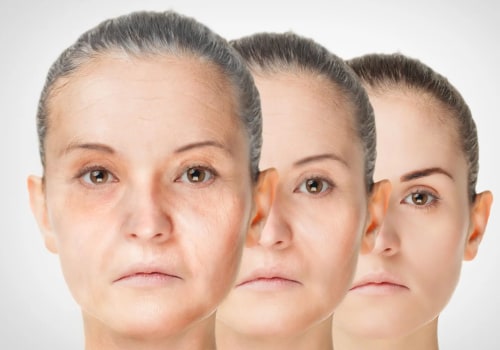 What is anti-aging therapy?